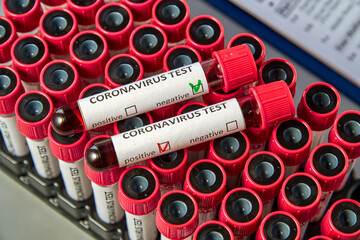 Blood test tubes for COVID-19 on vacuum tubes with blood samples. Blood test for the presence of...