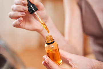 Woman with vitiligo skin preparing to applying hyaluronic serum