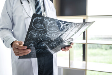 Doctor hands holding patient brain x-ray film before treatment and analyzing treat method