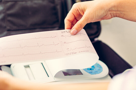 Examination of the patient's cardiac diagnosis, cardiogram, examination of human cardiovascular diseases, cardiograph and laboratory assistant.