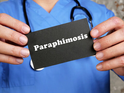 Medical concept meaning Paraphimosis with inscription on the sheet.