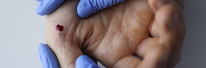 Doctor in gloves holds the patient's hand with blood. Medical assistance and taking tests concept