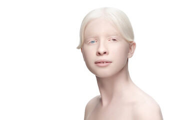 Beautiful albino woman with heterochromia isolated on white studio background. Copyspace for ad....