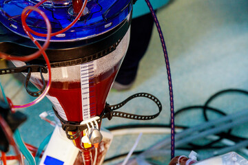 Apparatus circulation blood heart lung machine for heart surgery in operating room