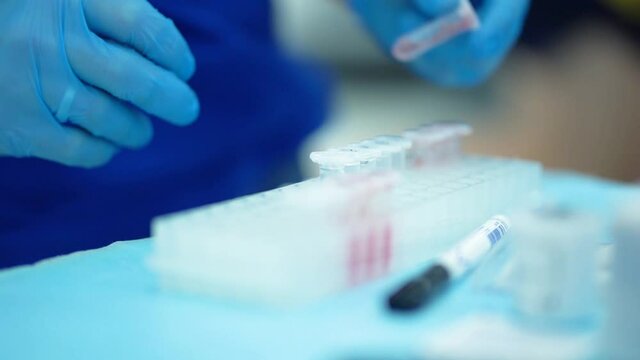 Medical scientist working in lab with probes test tubes glasses. genetic biohacking medicine research. Sport medicine research blood test professional athlete and scientist in modern lab close-up