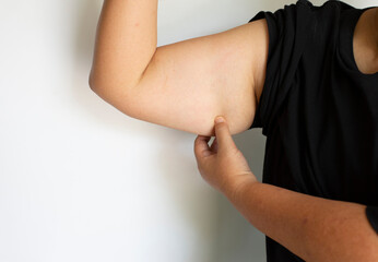Picture of woman gesture showing back muscles, under arms, with fat under the skin.