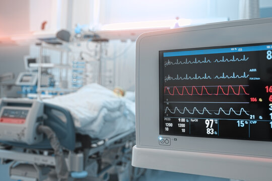 Heart monitor with ECG lines on the background of critical patient in the intensive care unit