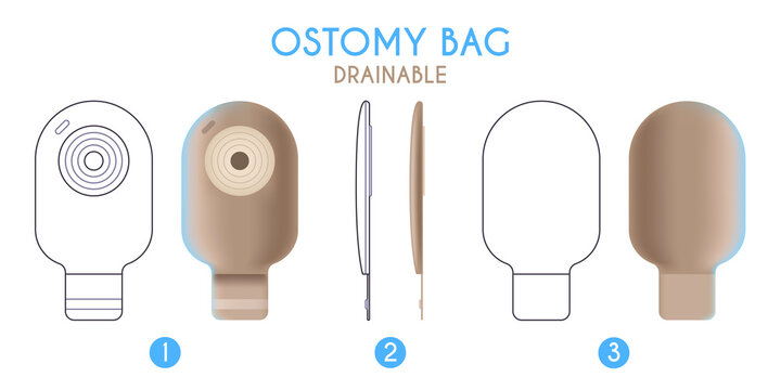 Ostomy bag drainable illustration schematic image