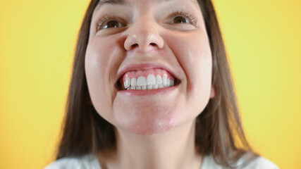 Close-up of young woman smiles broadly, shows her gums, her white, uneven teeth. Dental care concept, perfect smile