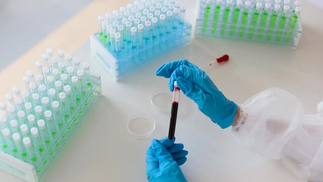 Vew from eyes: octor in a white protective overalls and a respirator take a test tube with blood sample from holder. FHD video.
