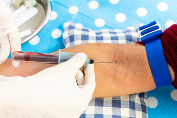 Nurse taking blood sample from the patient's arm vein for blood test.