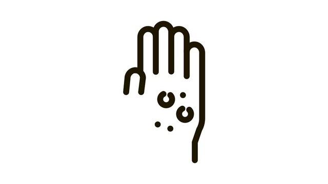 dermatitis rash on hands Icon Animation. black dermatitis rash on hands animated icon on white background