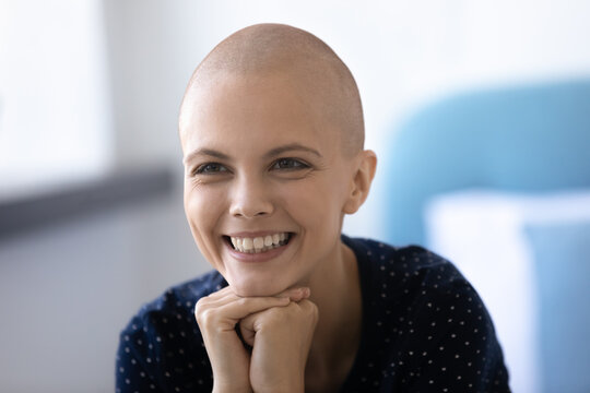 I Know It Will Be All Right. Close Up Shot Of Laughing Hairless Young Female Getting Oncology Treatment Receiving Good Lab Test Results. Optimistic Woman Cancer Patient Feel Happy Going Into Remission