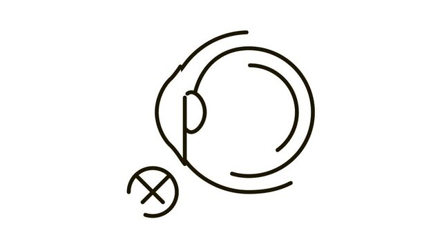 Eyeball Glaucoma Icon Animation. black Eyeball Glaucoma animated icon on white background