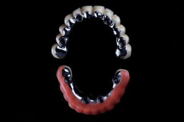 titanium dental beams with ceramics, top view on a black background