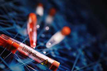 Test tube with patient blood for testing. Analysis for the virus. Coronavirus pandemic laboratory...
