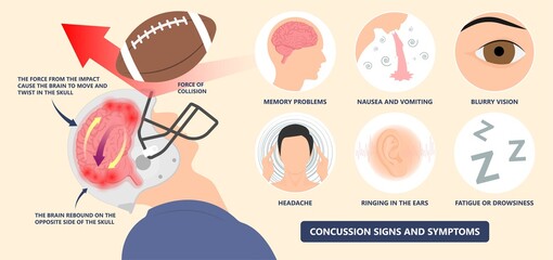 Brain Injury mild post head bleed sport loss second bump blow jolt hit skull ear contact hockey trauma fall pain athlete ball  rugby play 