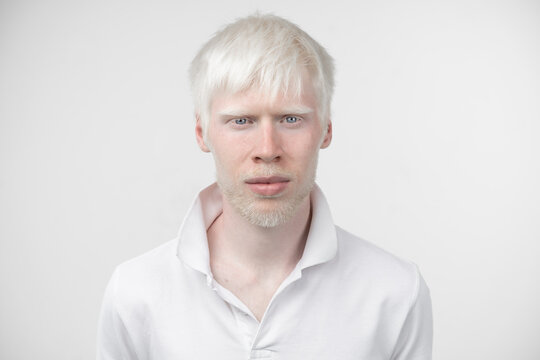portrait of an albino man in  studio dressed t-shirt isolated on a white background. abnormal deviations. unusual appearance