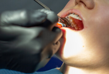 A woman at a dentist's appointment to replace arches with braces.