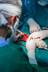 Microvascular forearm surgery in hospital