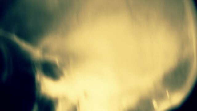 Close up of a front and side skull x-rays moving erratically on the screen. Seamless loop.