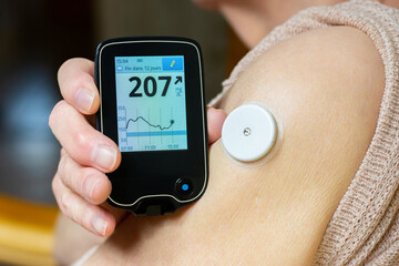 Lecteur de glycémie sans piqûre