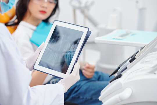 Dentist checking jaw x-ray of young female patient on tablet computer
