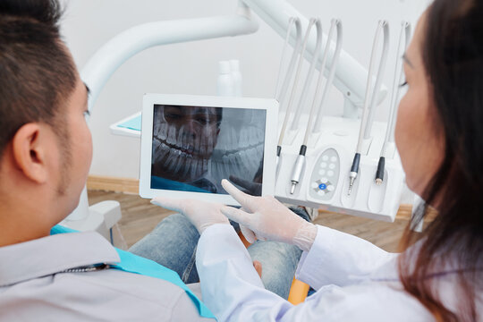 Orthodontist showing jaw x-ray to patient and telling what teeth should be treated or removed