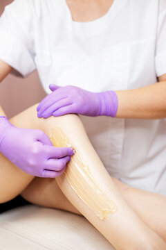 Hair removal at spa depilation studio. Woman legs with sugaring wax and cosmetologist hands in colored rubber gloves. Hot sugar. Vertical.