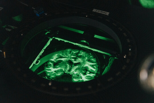 Human brain slide in illuminated microscope at laboratory