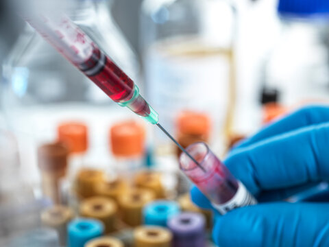 Biomedical scientist working with blood sample at laboratory