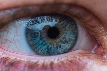 Bloodshot Blue Eye