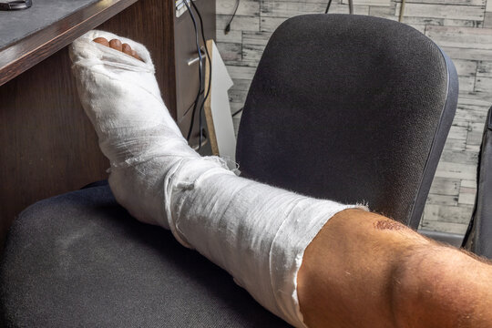 Leg in bandage fixed after bone broken.