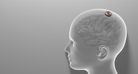 Neuralink surgical implant, neurotechnology connecting brain-machine interfaces to humans and computers