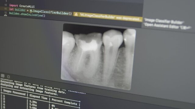 Jaw teeth Xray Analysis with Neural Network