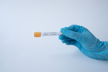 Obraz premium new strain of coronavirus SARS-CoV-2 VUI – 202012-01. Covid-2020. medicine, healthcare and pandemic concept. test tube. close up. mutation, mutated. medical gloves.