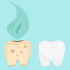 Set of rotten and healthy tooth in cartoon style isolated on blue background. The importance of daily care for the health and cleanliness of teeth. Vector illustration..