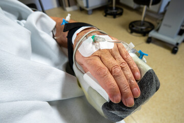 in a hand of an operated patient is venous cannula for infusion