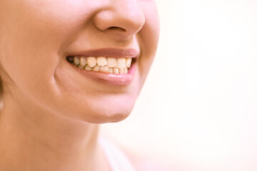 Close up of young woman's face with crooked teeth. Teeth before install braces. Teeth need...