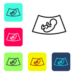 Black line Ultrasound of baby icon isolated on white background. Fetus. Set icons in color square buttons. Vector.