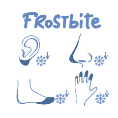 Frostbite icons set. Outline set of frostbite vector icons for web design isolated on white background