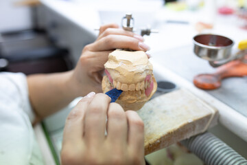High angle side view of crop unrecognizable skilled dental technician using articulator while working with plaster cast in dentistry laboratory