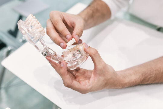 Dentist's hands pulling a tooth from a dental fantome