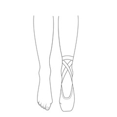Professional ballerinas hallux valgus