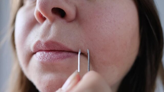 hair over the upper lip in women. girl with tweezers plucks a mustache. female antennae. problem skin