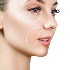 Female face with dotted area under eyes and near mouth. Plastic surgery anti-age concept.