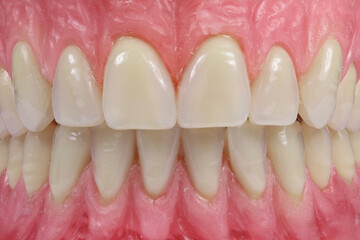 close up of a tooth model