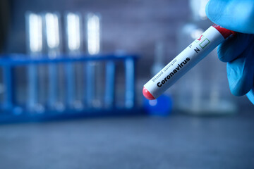Fototapeta premium laboratory technician hand holding blood test tube 