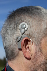cochlea implant close up, therapy, hearing aid, hearing aid for deaf people to restore hearing, hearing disability trying to hear something © Sarah