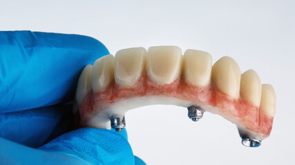 upper jaw prosthesis in the hand of an orthopedist on a white background